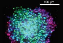 3D Screening of Anti-Cancer Drugs Employing Cell Aggregates Shows Promise 3D Screening of Anti-Cancer Drugs Employing Cell Aggregates Shows Promise
