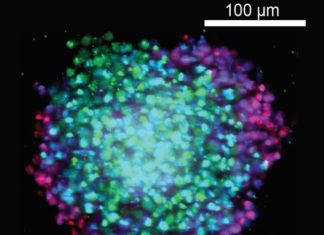 3D Screening of Anti-Cancer Drugs Employing Cell Aggregates Shows Promise 3D Screening of Anti-Cancer Drugs Employing Cell Aggregates Shows Promise