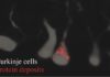 Study Identifies Gene That Reigns in Neurons, Can Prevent Protein Aggregates Study Identifies Gene That Reigns in Neurons, Can Prevent Protein Aggregates