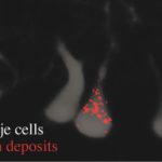 Study Identifies Gene That Reigns in Neurons, Can Prevent Protein Aggregates Study Identifies Gene That Reigns in Neurons, Can Prevent Protein Aggregates