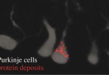 Study Identifies Gene That Reigns in Neurons, Can Prevent Protein Aggregates