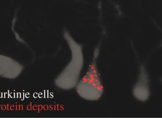 Study Identifies Gene That Reigns in Neurons, Can Prevent Protein Aggregates Study Identifies Gene That Reigns in Neurons, Can Prevent Protein Aggregates