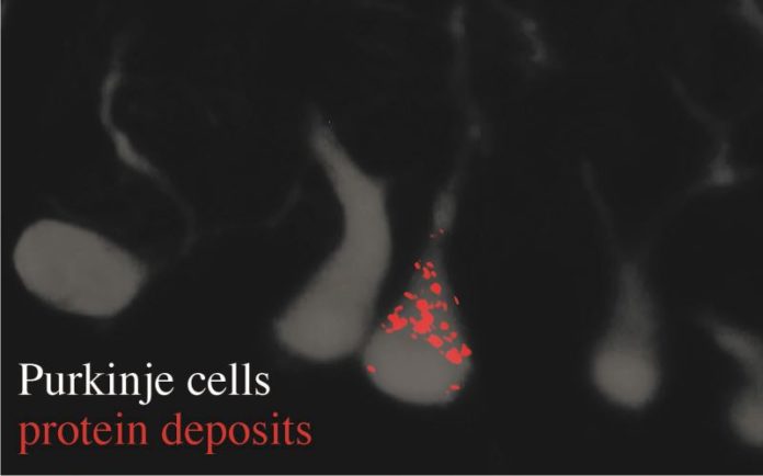 Study Identifies Gene That Reigns in Neurons, Can Prevent Protein Aggregates