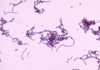 Flesh-Eating Bacterium Found to Hijack Immune System to Ensure Continued Survival Flesh-Eating Bacterium Found to Hijack Immune System to Ensure Continued Survival
