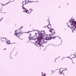Flesh-Eating Bacterium Found to Hijack Immune System to Ensure Continued Survival