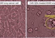 Green Tea Quantum Dots Promise Efficient Lung Cancer Treatment Strategies Green Tea Quantum Dots Promise Efficient Lung Cancer Treatment Strategies