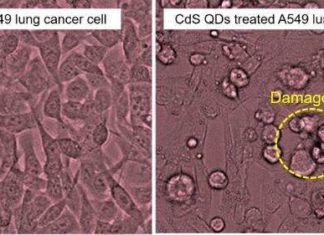 Green Tea Quantum Dots Promise Efficient Lung Cancer Treatment Strategies Green Tea Quantum Dots Promise Efficient Lung Cancer Treatment Strategies