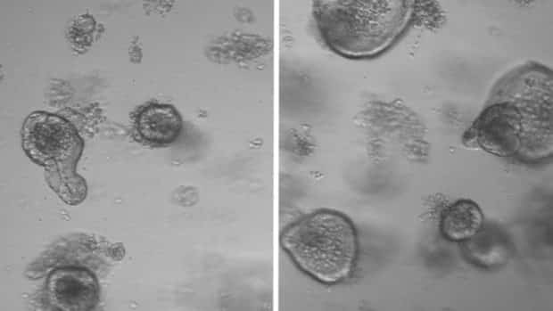 (Intestinal organoids from mice that fasted for 24 hours (R) and from mice that did not fast (L). Credit: Maria Mihaylova and Chia-Wei Cheng)