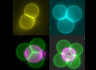 Using Miniature “Tractor Beams” to Rearrange Artificial Cells into Tissues Using Miniature “Tractor Beams” to Rearrange Artificial Cells into Tissues