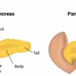 Targovax’s Neo-Antigen Immunotherapy for Pancreatic Cancer Shows Promise in Phase I/II 
