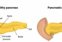 Targovax’s Neo-Antigen Immunotherapy for Pancreatic Cancer Shows Promise in Phase I/II Targovax’s Neo-Antigen Immunotherapy for Pancreatic Cancer Shows Promise in Phase I/II