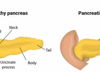 Targovax’s Neo-Antigen Immunotherapy for Pancreatic Cancer Shows Promise in Phase I/II Targovax’s Neo-Antigen Immunotherapy for Pancreatic Cancer Shows Promise in Phase I/II