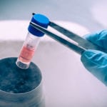 World’s First Revolutionary iPS Cells Trial to Treat Heart Diseases