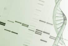 Buy Chemiluminescent HRP Substrates Online For Lab Research