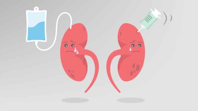35 Crucial Genes Related To Chronic Kidney Disease Identified