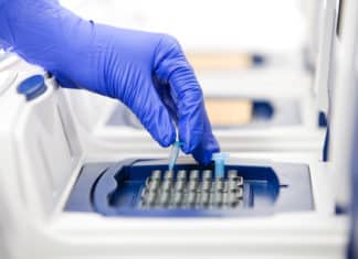 Buy PCR Thermal Cyclers at Affordable Price Online Buy PCR Thermal Cyclers at Affordable Price Online