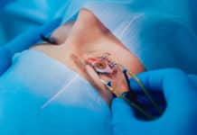Glaucoma Eye Pressure Sensors Implanted In First Human Clinical Trial