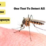 Novel Test For Detecting Zika, Dengue, Chikungunya In minutes