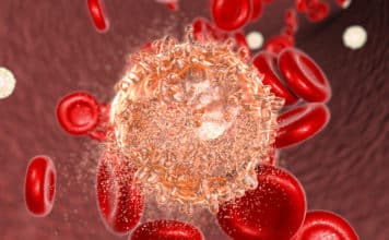 AbbVie Lupin $977M+ Partnership to Develop Blood Cancer Inhibitors AbbVie Lupin $977M+ Partnership to Develop Blood Cancer Inhibitors