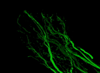 First Imaging Technique That Makes Organism Completely Transparent