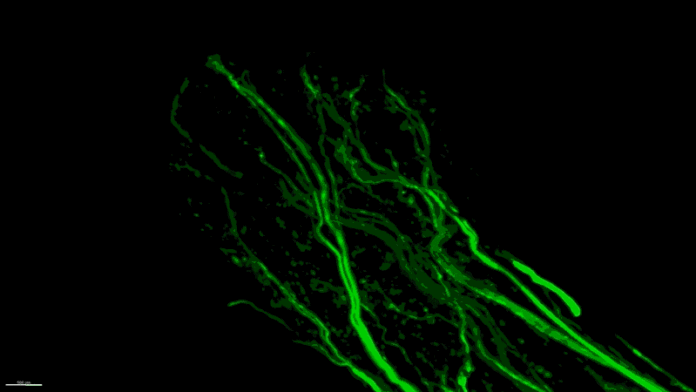 First Imaging Technique That Makes Organism Completely Transparent