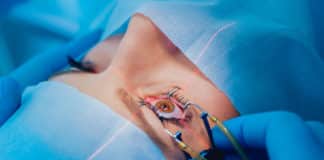First Human Trial For Stem Cell Based AMD Therapy By NIH