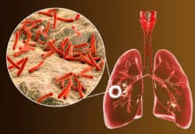 Indian Researchers Discover Potential Drugs Against Tuberculosis Indian Researchers Discover Potential Drugs Against Tuberculosis