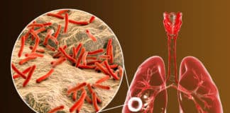 Indian Researchers Discover Potential Drugs Against Tuberculosis