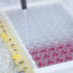 An Overview of ELISA - Types of ELISA, ELISA Kits, ELISA Buffer-Probes