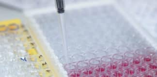 An Overview of ELISA - Types of ELISA, ELISA Kits, ELISA Buffer-Probes