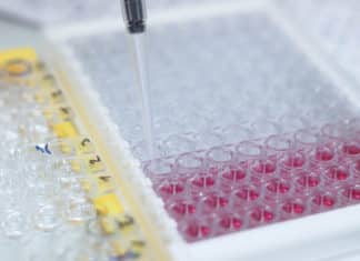 An Overview of ELISA - Types of ELISA, ELISA Kits, ELISA Buffer-Probes