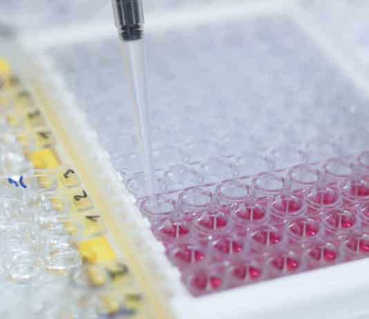 An Overview of ELISA - Types of ELISA, ELISA Kits, ELISA Buffer-Probes