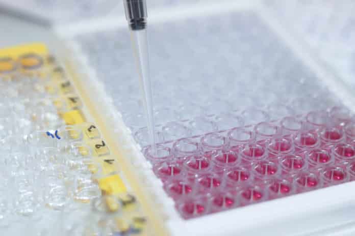 An Overview of ELISA - Types of ELISA, ELISA Kits, ELISA Buffer-Probes