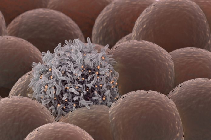 100% Effective Cure For Cancer By "MuTaTo" Claims Israeli Scientists