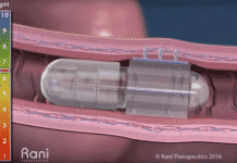 Rani Therapeutics News: Human safety study of its robo biologic pill completed Rani Therapeutics