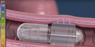 Rani Therapeutics