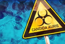Candida auris Outbreak – A Serious Global Health Threat Candida auris Outbreak - A Serious Global Health Threat