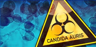 Candida auris Outbreak - A Serious Global Health Threat
