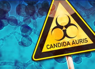 Candida auris Outbreak - A Serious Global Health Threat