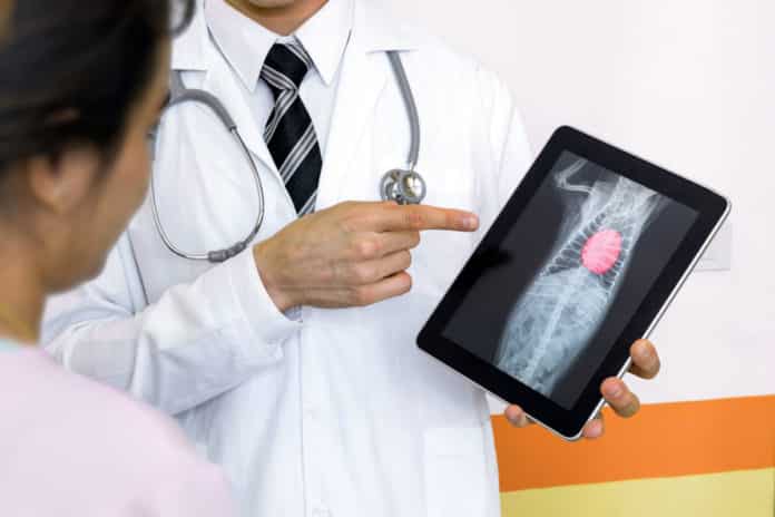 DBT To Initiate Pilot Project On Using AI For Cancer Predictive Tools