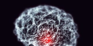 Alzheimer’s Disease Analysis Via Gene Expression Mapping in Single Cell