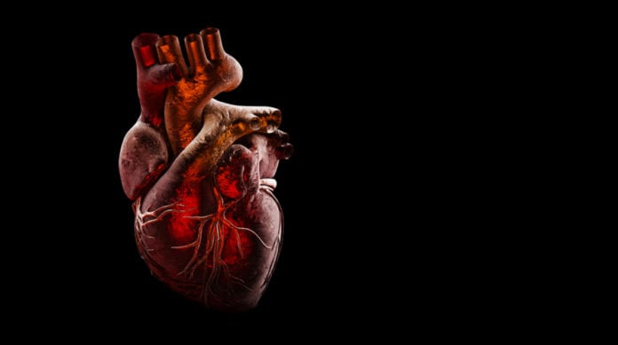 Cardiac Repair Successful In Pigs Using MicroRNA Therapy