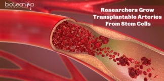 Researchers Grow Transplantable Arteries From Stem Cells