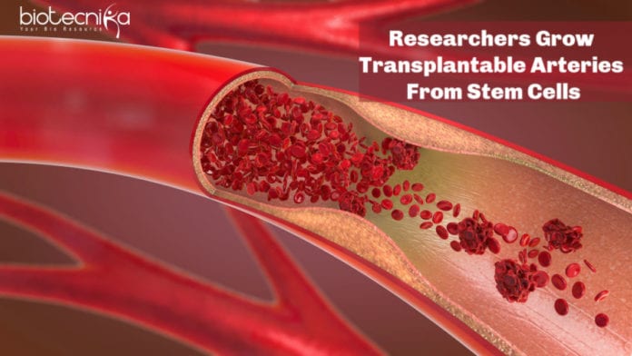 Researchers Grow Transplantable Arteries From Stem Cells