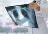 Effective Drug Combinations To Treat Tuberculosis Discovered