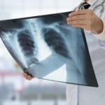 Effective Drug Combinations To Treat Tuberculosis Discovered