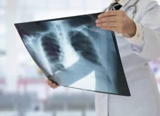 Effective Drug Combinations To Treat Tuberculosis Discovered Effective Drug Combinations To Treat Tuberculosis Discovered