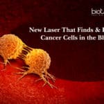 New Laser That Finds & Destroy Cancer Cells in the Blood