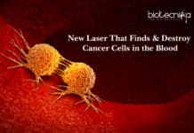 New Laser That Finds & Destroy Cancer Cells in the Blood New Laser That Finds & Destroy Cancer Cells in the Blood