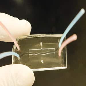 Human Pancreas On a Chip To Identify CF-Related Diabetes